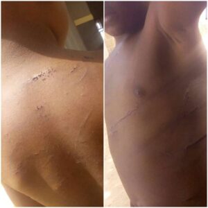 A rights advocacy group, the Men Against Rape Foundation (MARF), has condemned the brutal assault of a four-year-old orphan, Ukasha, by his uncle and guardian, one Mai-Naira Abdullahi, in Lafia, the Nasarawa State capital.